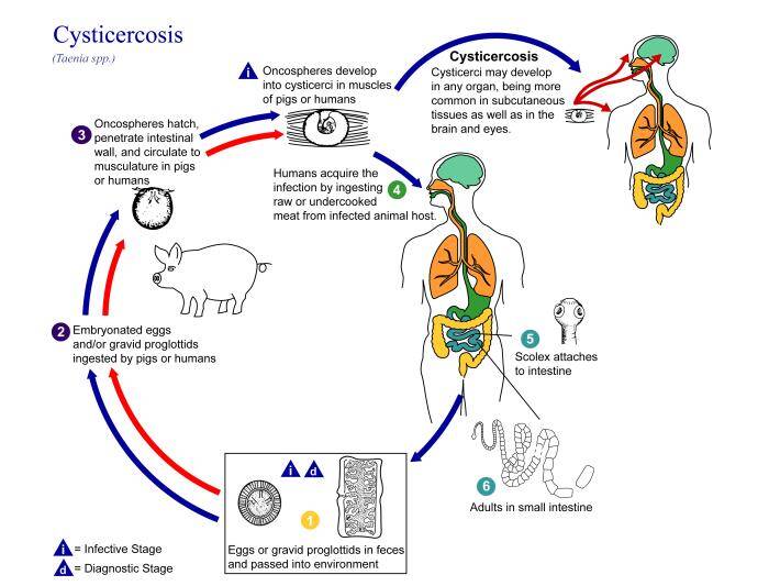 Cysticercus Cellulosea Infection