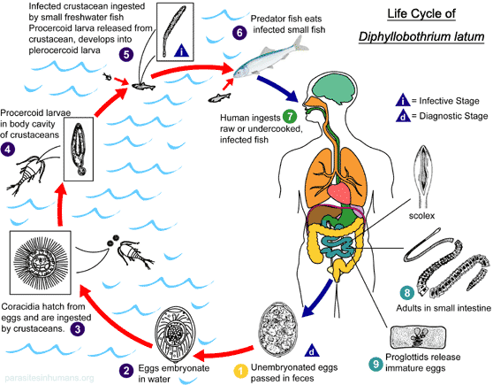 Diphyllobothrium latum infection